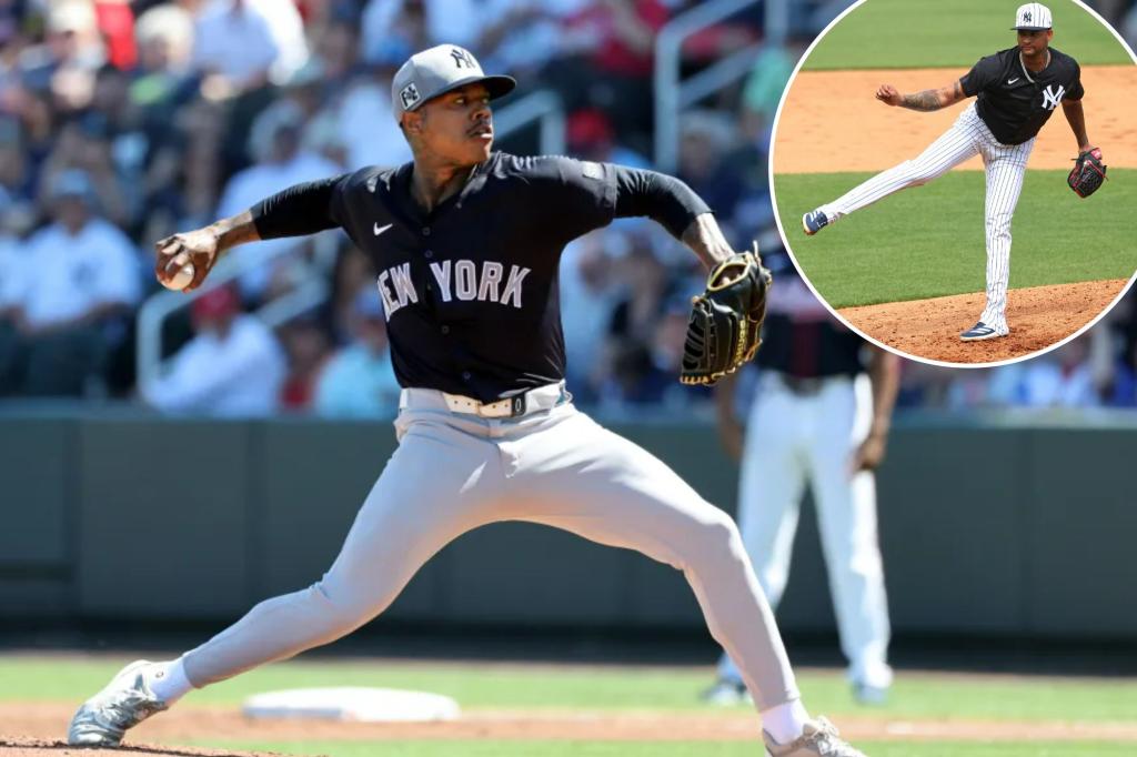양키스는 Marcus Stroman의 또 다른 초기 충격이 필요할 수 있습니다