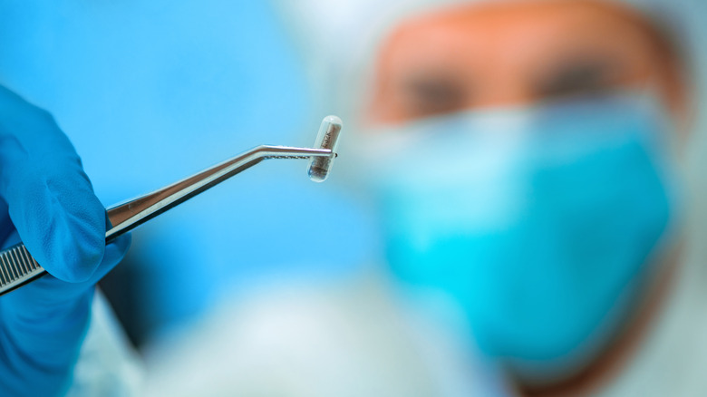 의사는 핀셋으로 RFID 임플란트를 보유하고 있습니다.